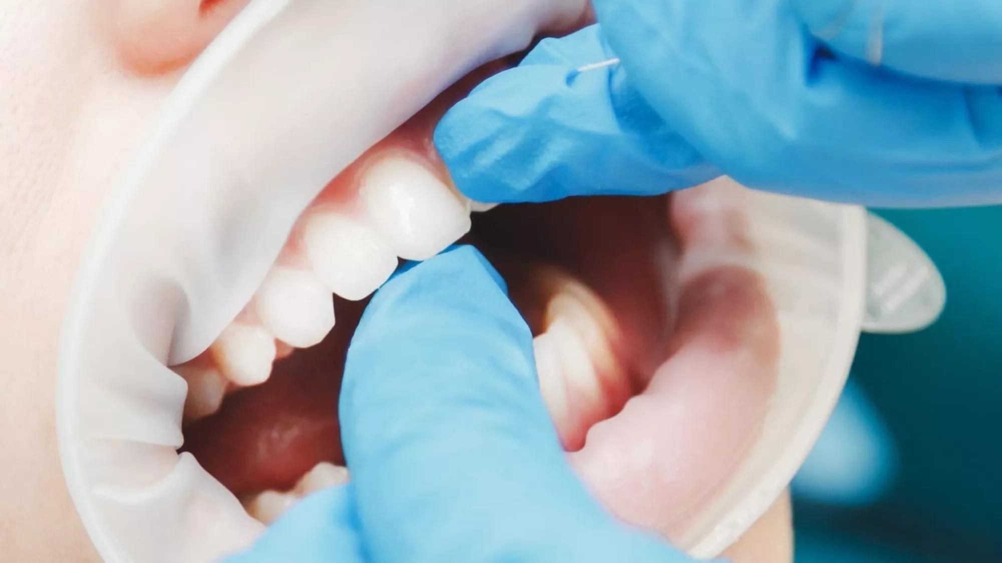 Taylor Life in Other Word